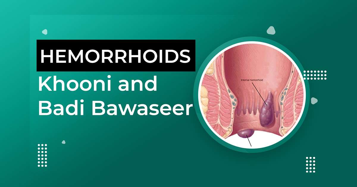 Hemorrhoids Khooni and Badi Bawaseer