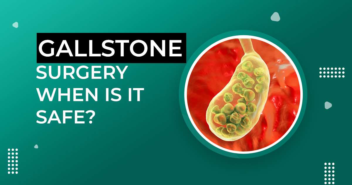 Gallstone surgery When Is It Safe