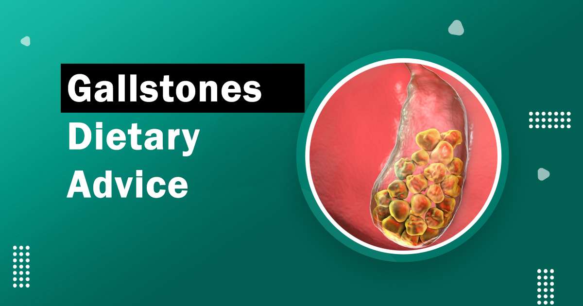 Gallstones Dietary Advice