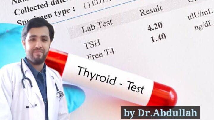 thyroid test in urdu
