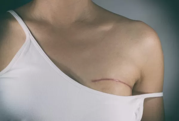 cost of breast surgery in karachi