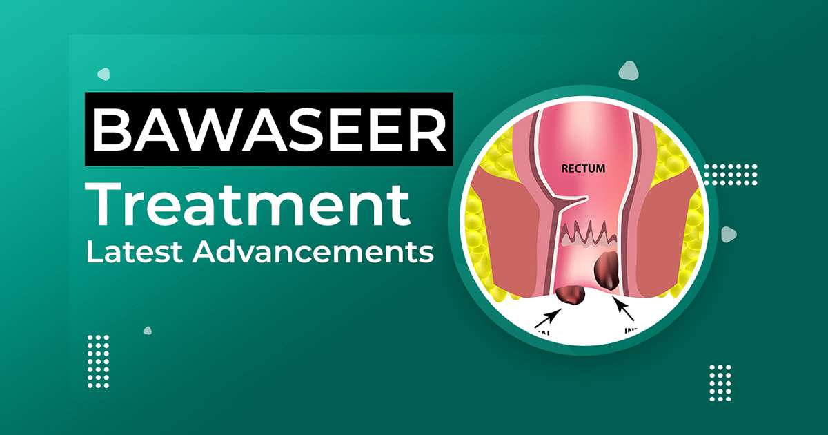 Bawaseer Treatment Latest Advancements