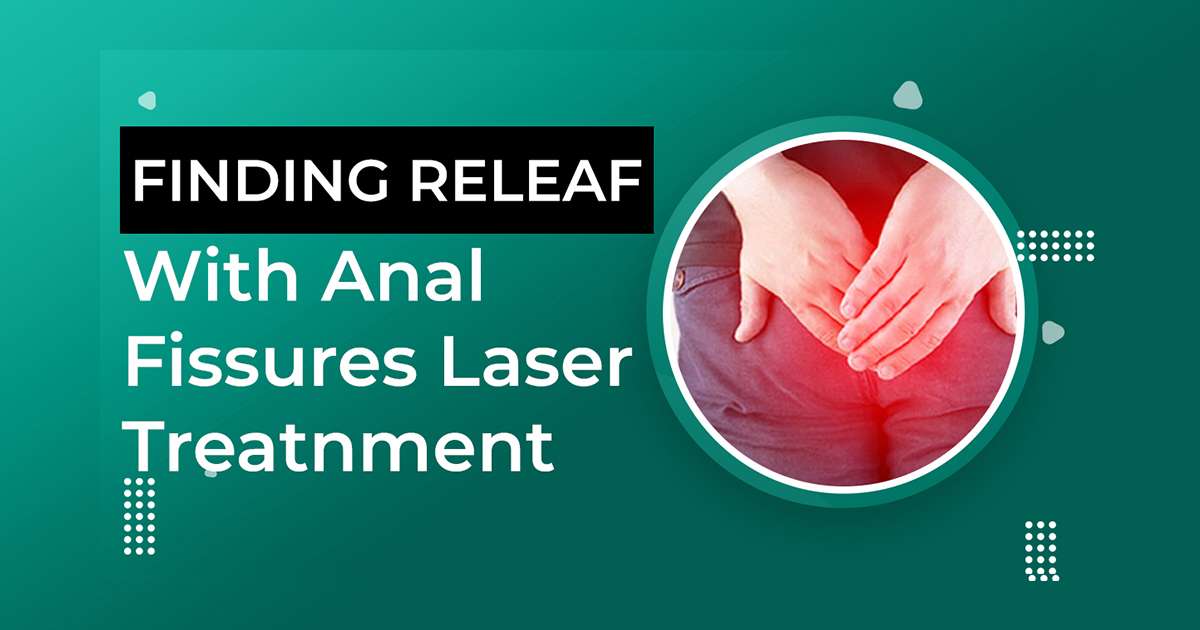 Anal Fissure Laser Treatment