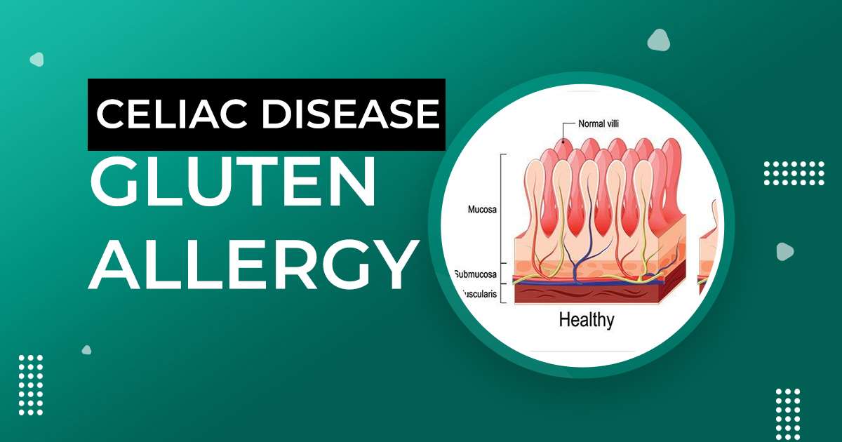 Celiac Disease