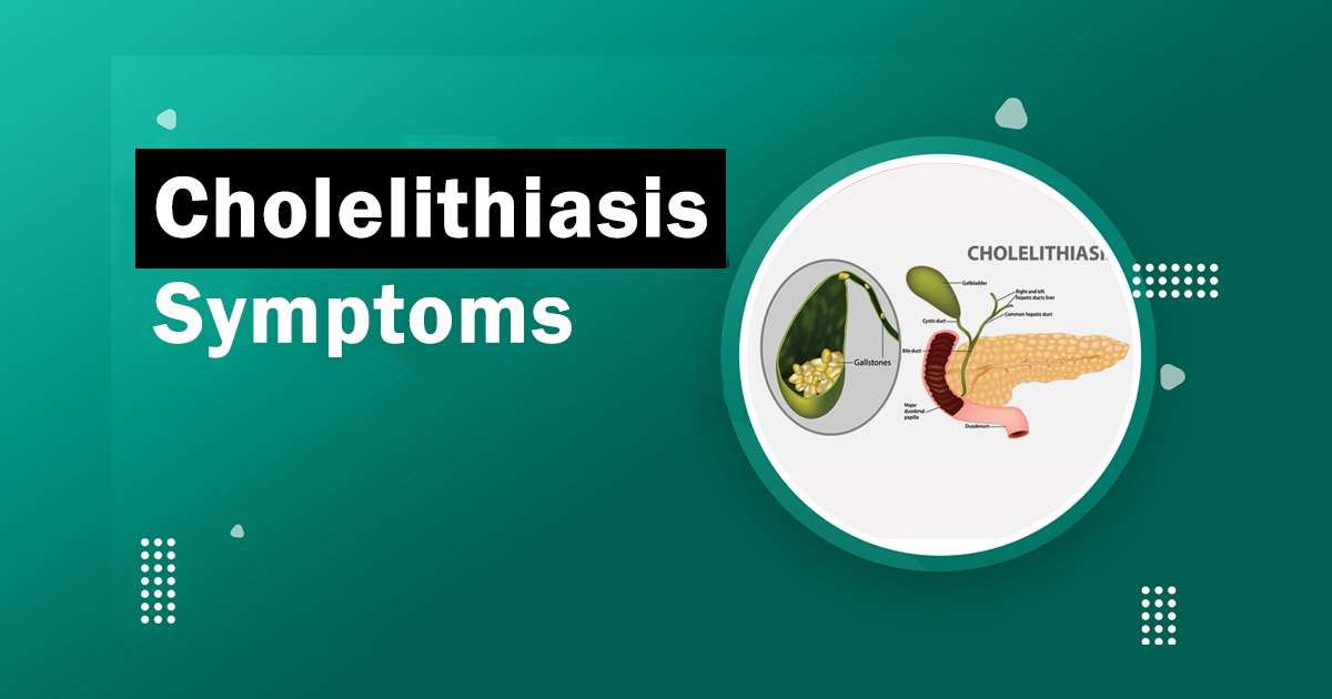 cholelithiasis meaning in Urdu