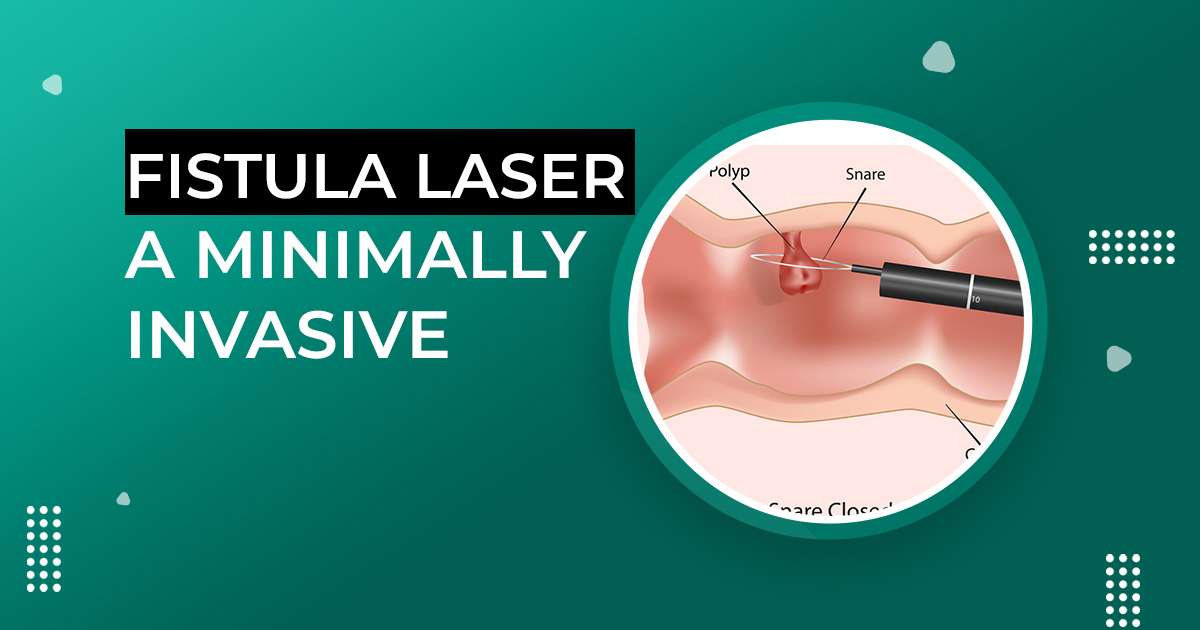 Fistula Laser A Minimally Invasive