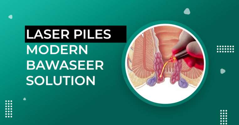 laser treatment for piles