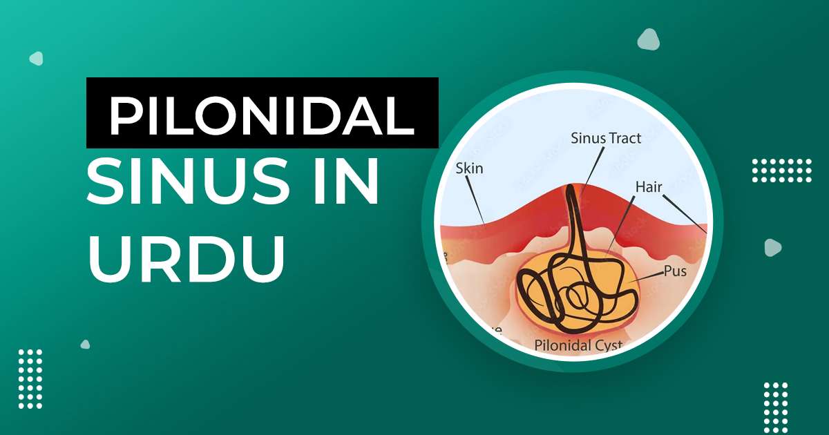 Pilonidal Sinus In Urdu