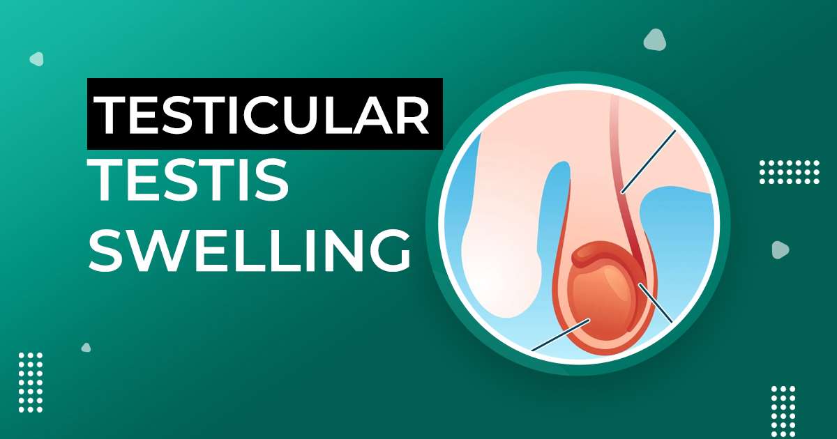 Testicular pain