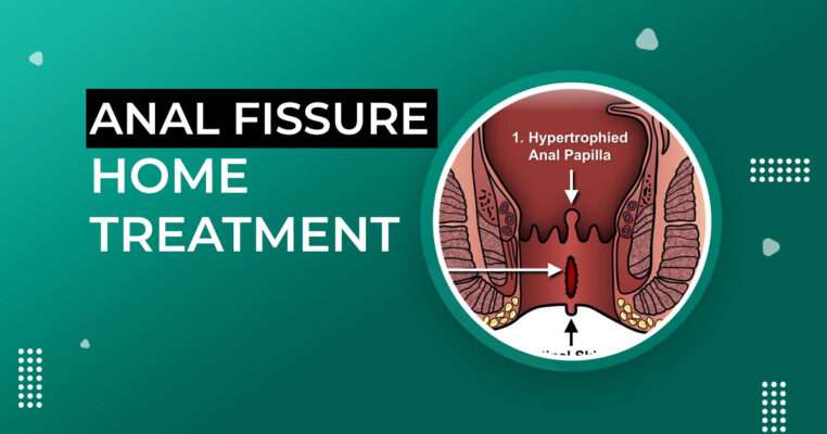 anal Fissure Home Treatment