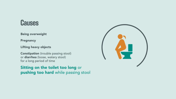 piles causes