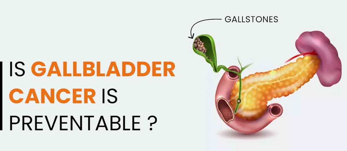 gallbladder cancer ka ilaj