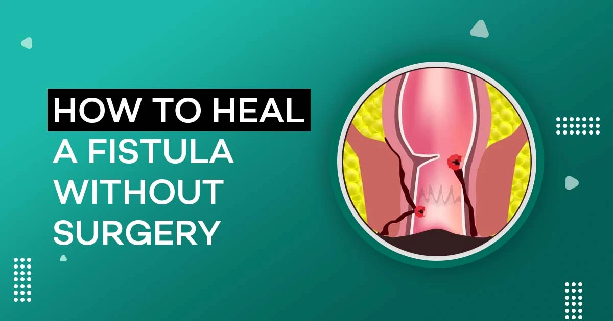 How to Heal a Fistula Without Surgery