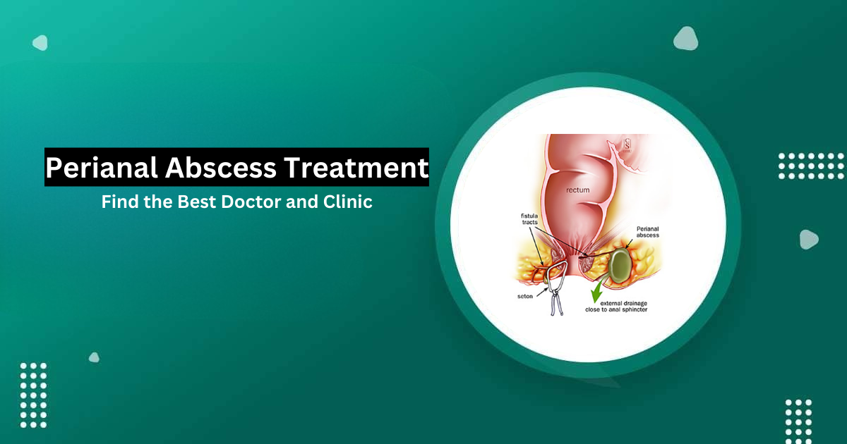 perianal abscess treatment