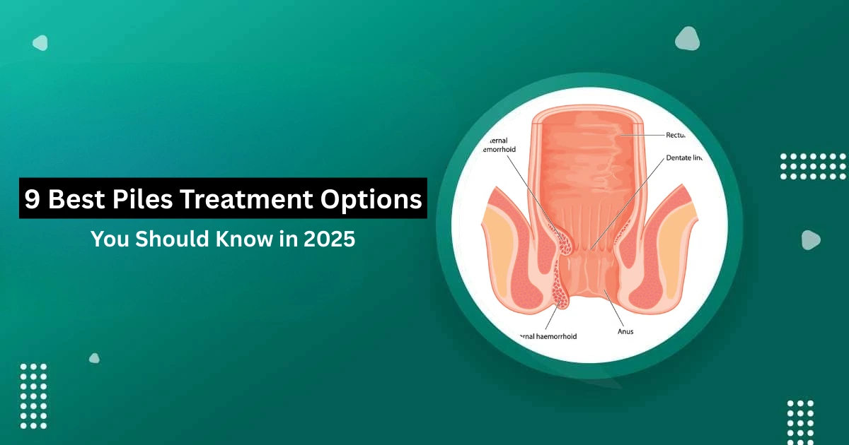 best piles treatment option
