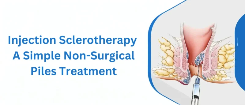 best piles treatment option