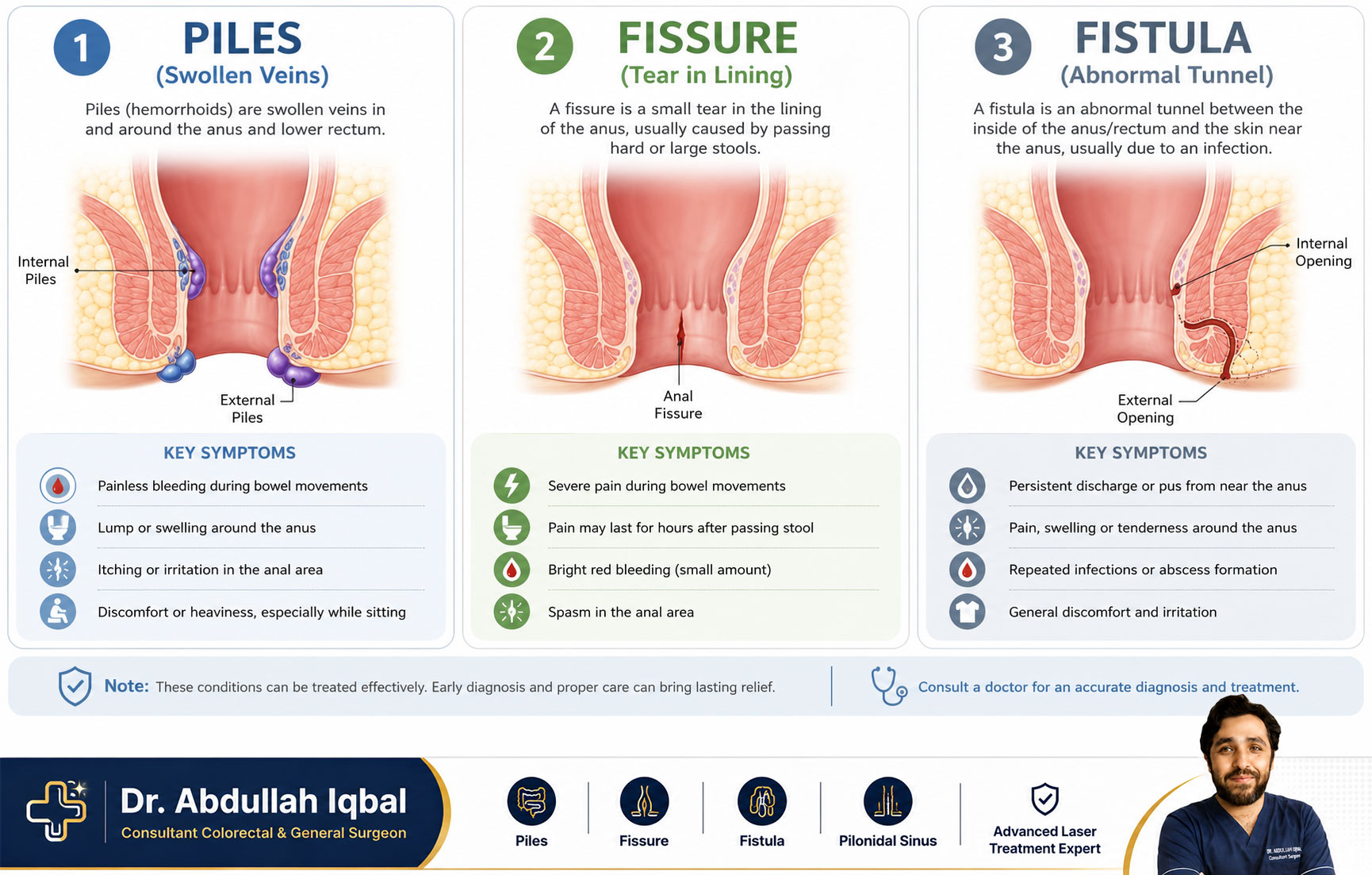 Difference between piles, fissure and fistula — comparison diagram