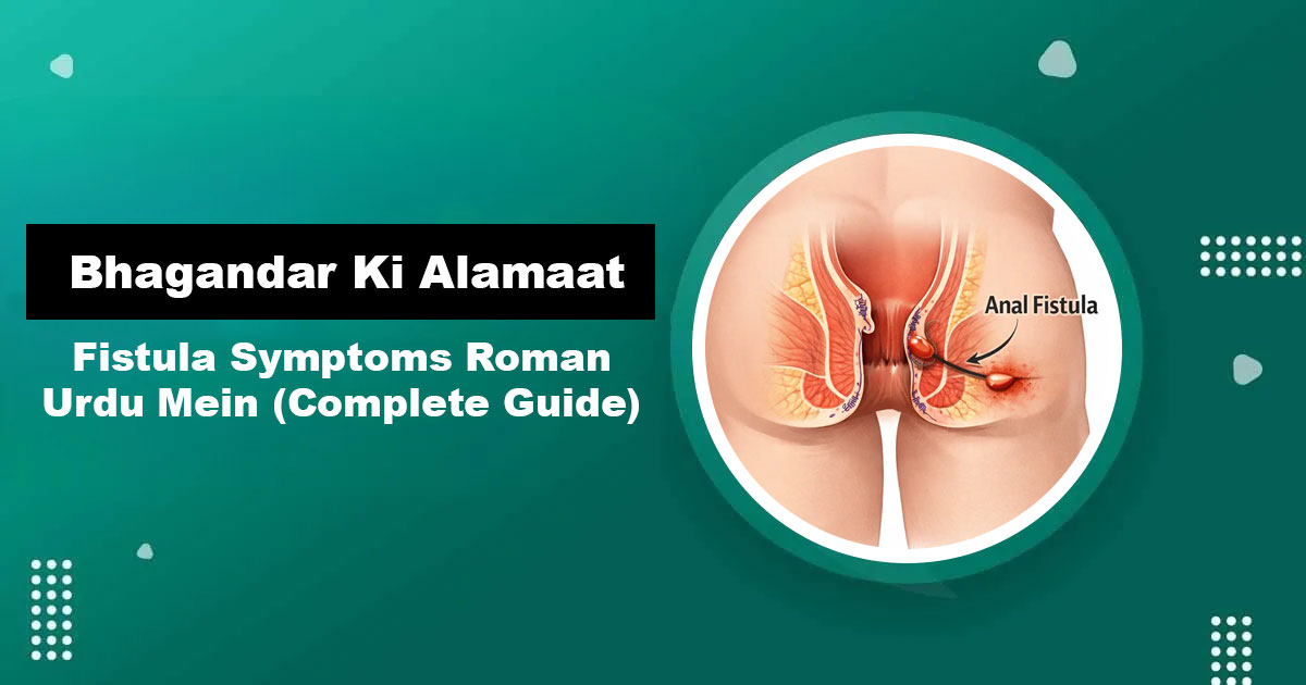 Bhagandar Ki Alamaat — Fistula Symptoms in Urdu