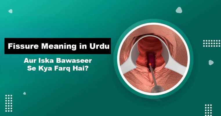 Fissure Meaning in Urdu — Fissure Aur Bawaseer Ka Farq
