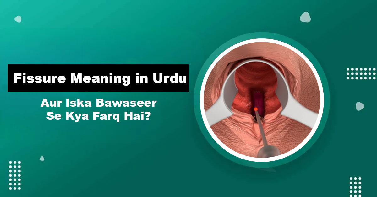 Fissure Meaning in Urdu — Fissure Aur Bawaseer Ka Farq