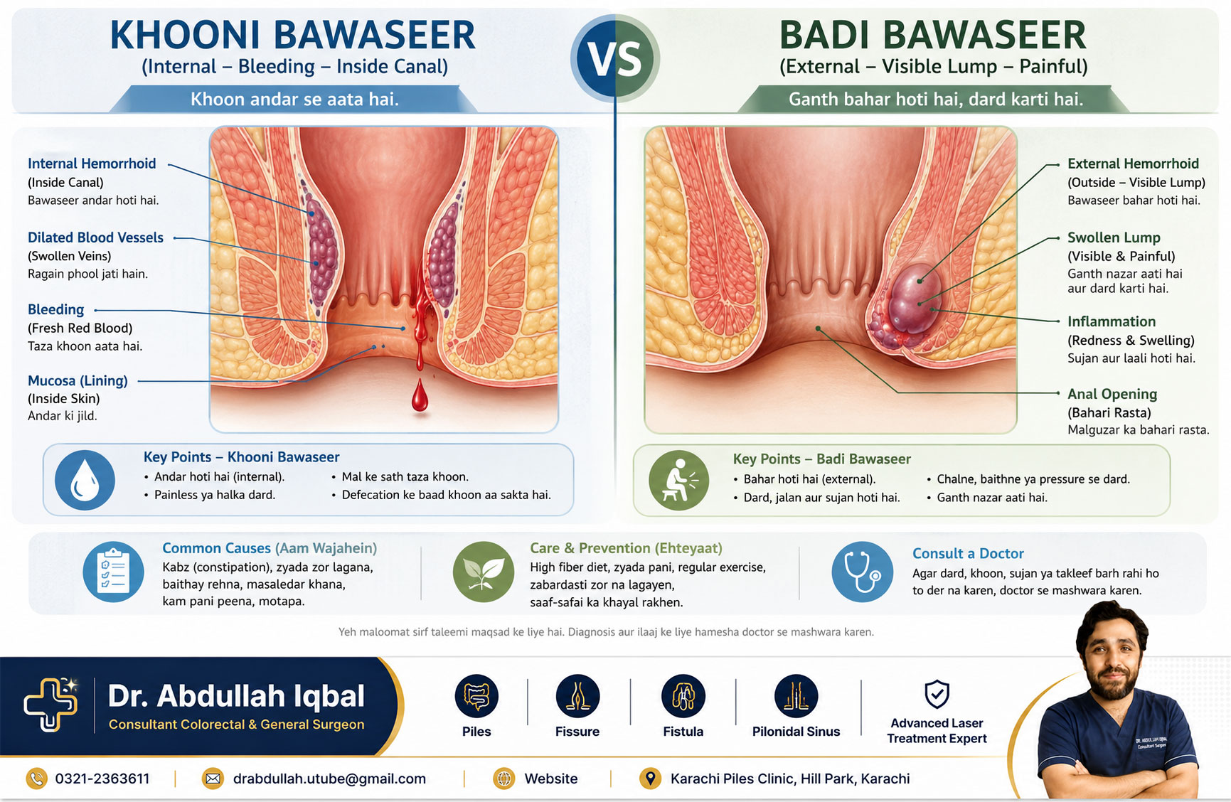 Internal (khooni) vs external (badi) bawaseer
