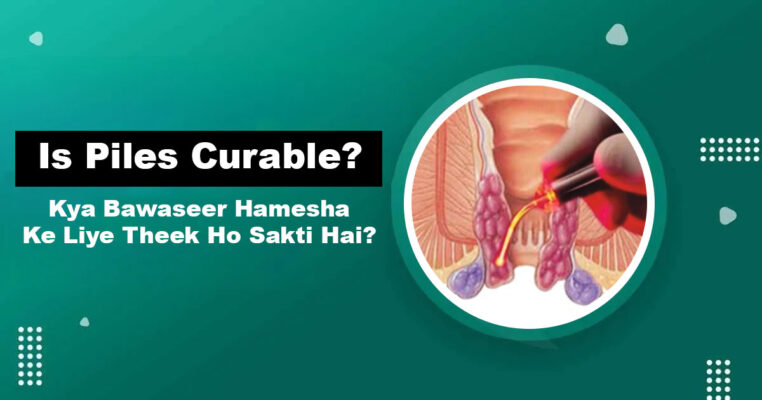 Is Piles Curable — Permanent Bawaseer Treatment Karachi