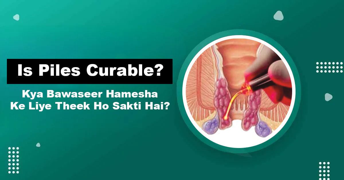 Is Piles Curable — Permanent Bawaseer Treatment Karachi