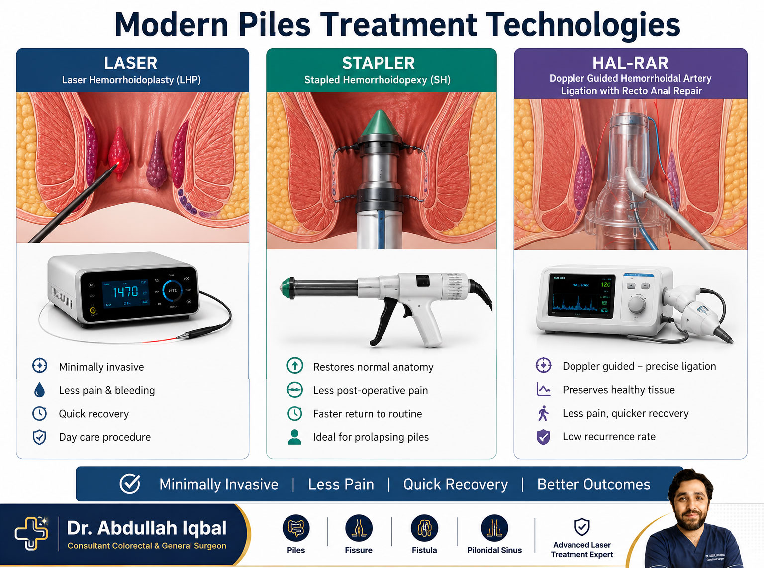 Modern piles treatment technologies — laser, stapler, HAL-RAR