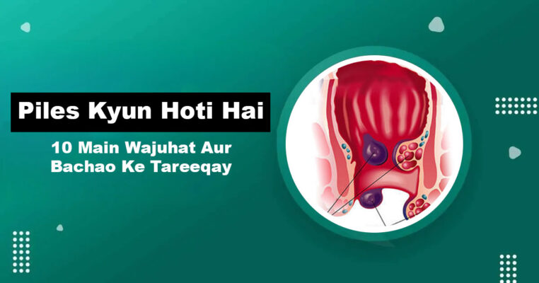 Piles Causes — Bawaseer Kyun Hoti Hai 10 Wajuhat