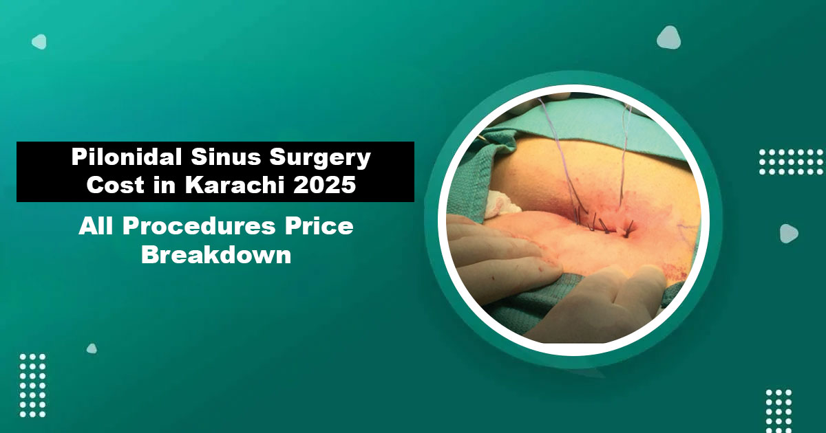 Pilonidal Sinus Surgery Cost in Karachi 2025 — Price Breakdown