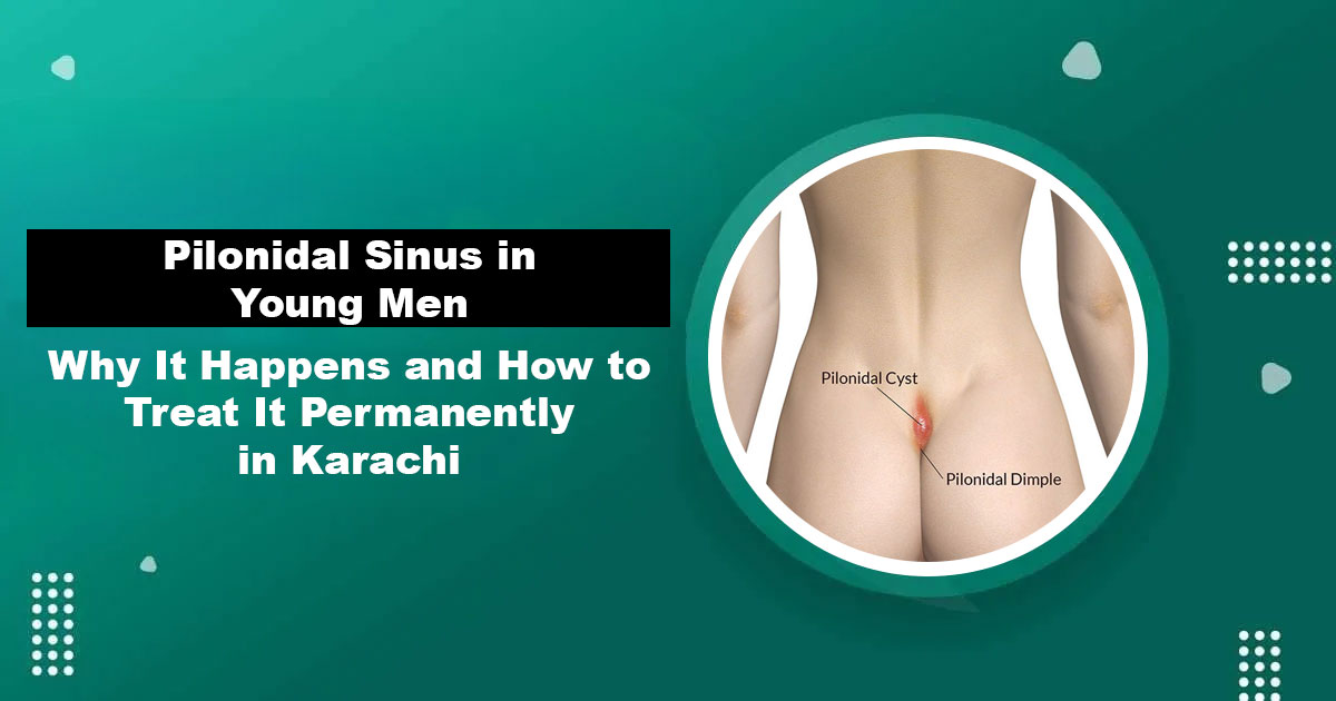 Pilonidal Sinus in Young Men — Causes and Treatment Karachi