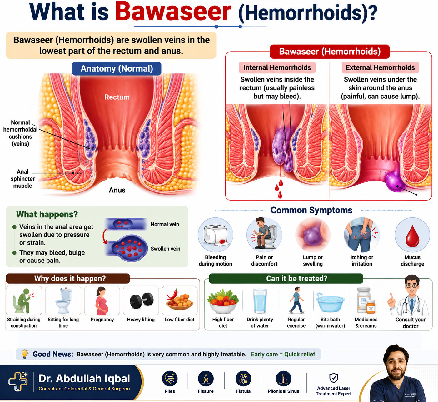 What is bawaseer — anatomy explained for patients