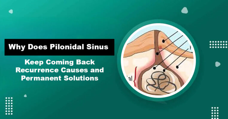 Pilonidal Sinus Recurrence — Causes and Permanent Treatment in Karachi